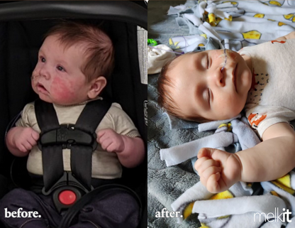 Bébé Melk
