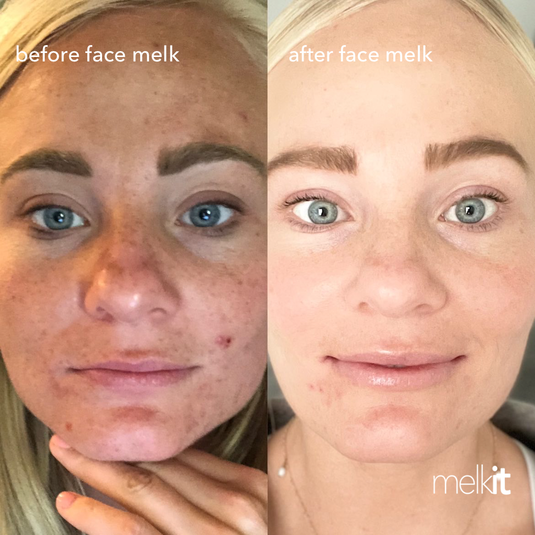 Face Melk